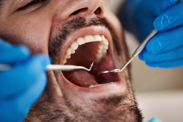 Best Broken or Cracked Tooth Emergency Dentist in Austin, AR