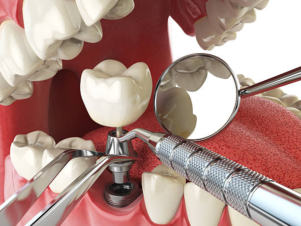 Best Mobile Emergency Dentist in Austin, AR